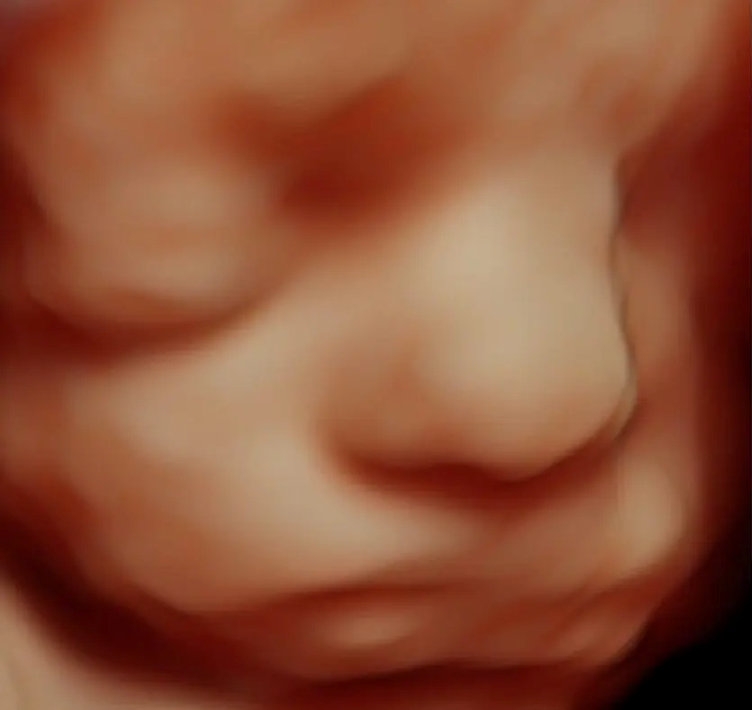 Imagem de um ultrassom 3D